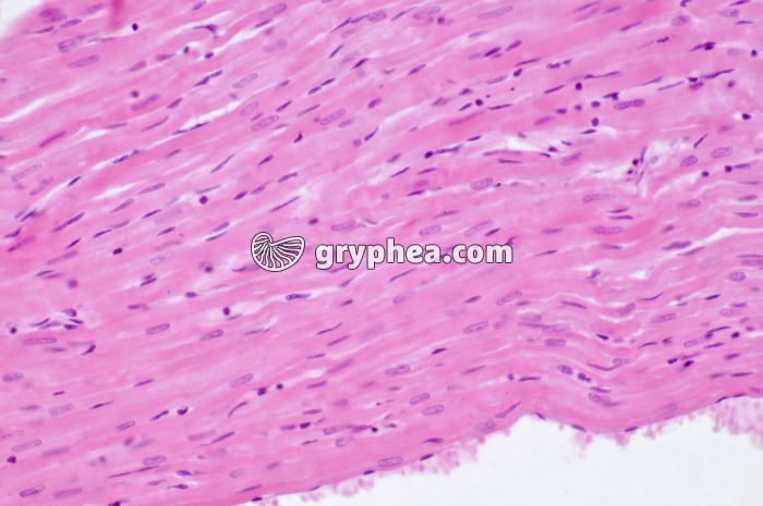 Mucle cardiaque CL x100 - gryphea.com